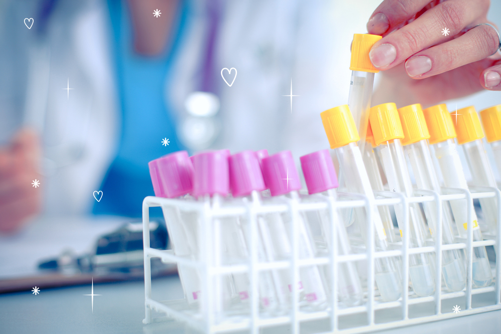 Анализ на витамин D (25-OH)