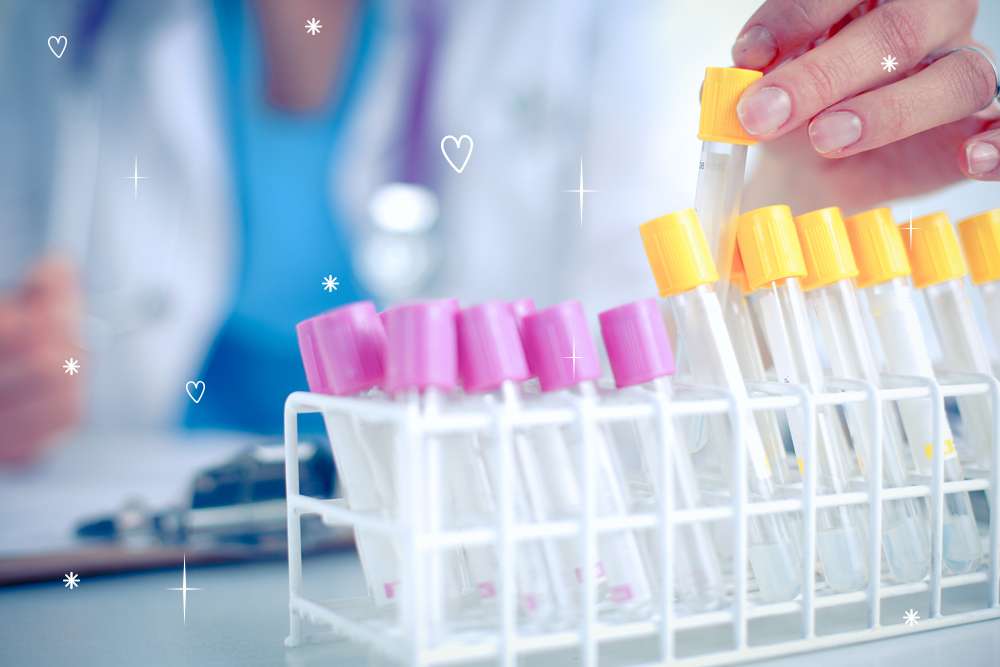 Альфа-1-антитрипсин, концентрация (А1АТ, Alpha-1-Antitrypsin сoncentration, A1-Antitrypsin, A1A, AAT)